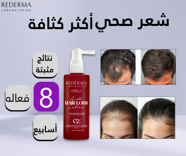 Your paragraph text Rederma - Gen Z – Hair Loss Treatment- Hair Grow Spray – Caffeine, Biotin & Garlic Extract – Strengthens Roots & Revives Scalp – Leave-in Tonic - 100ml